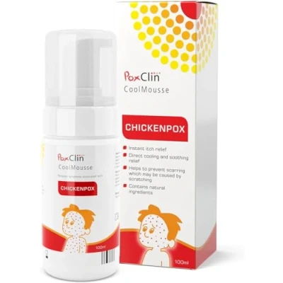 Imagen de PoxClin CoolMousse 100 ml Tratamiento contra la varicela en niños Alivia los Síntomas y el Picor de piel Ingredientes Naturales para pieles resecas, irritadas o dañadas