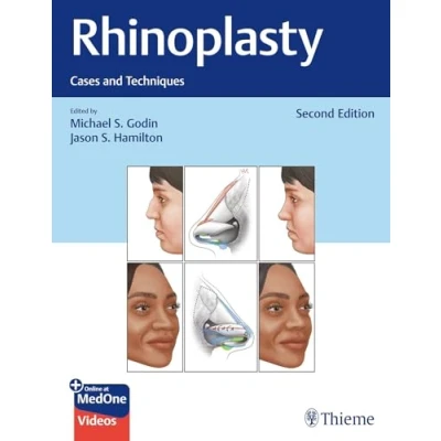 Imagen de Rhinoplasty: Cases And Techniques